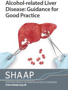 Alcohol-related Liver Disease: Guidance for Good Practice