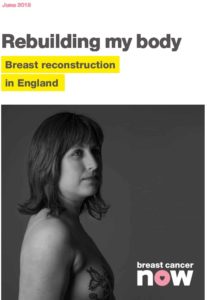 Rebuilding my body: Breast reconstruction in England